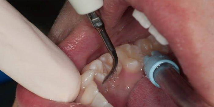 Examen dental Cartagena