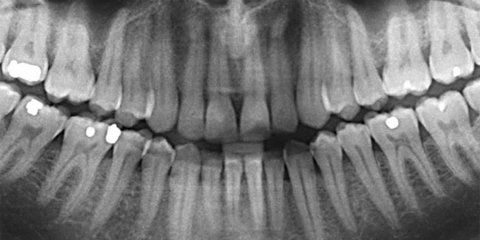 Consulta dental radiografia Cartagena