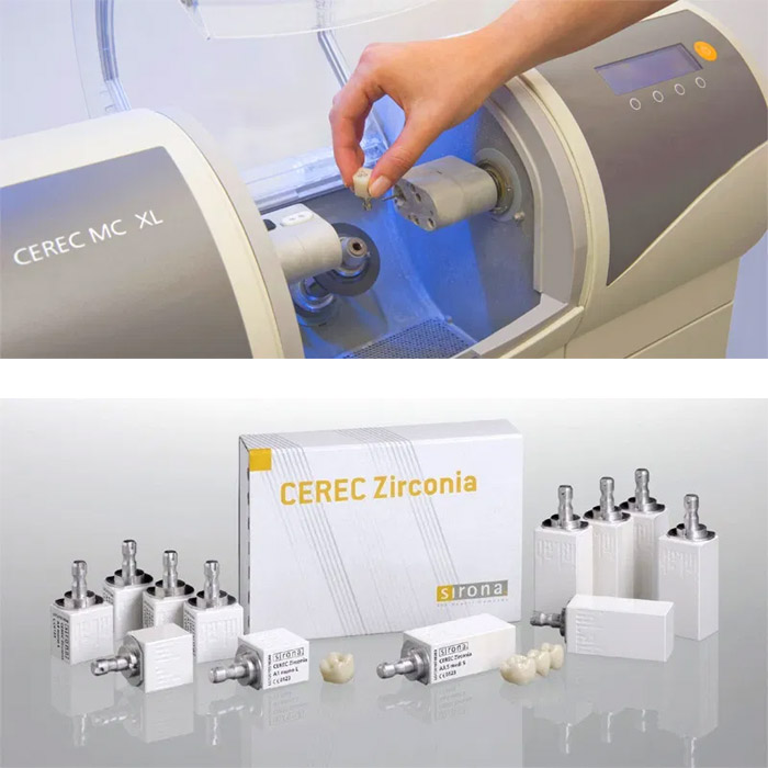 Fabricación de coronas dentales asistidas por ordenador de tipo CEREC