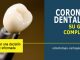 Corona dental en Cartagena