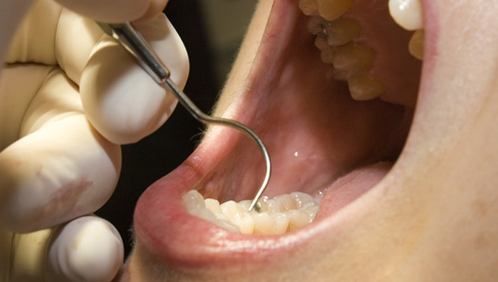 Examen de dientes y boca