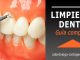 Limpieza dental Cartagena Colombia