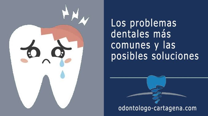 Problemas dentales y soluciones