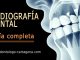 Radiografia dental en Cartagena