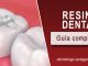 Resina dental Cartagena Coombia