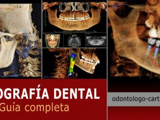 Tomografia dental en Cartagena