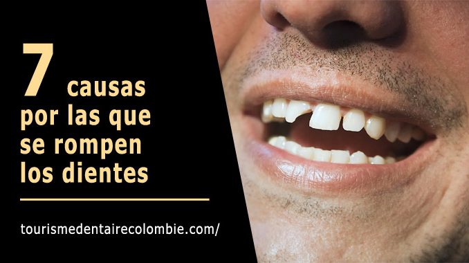 Causas dientes rotos