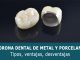 Corona dental de metal y porcelana