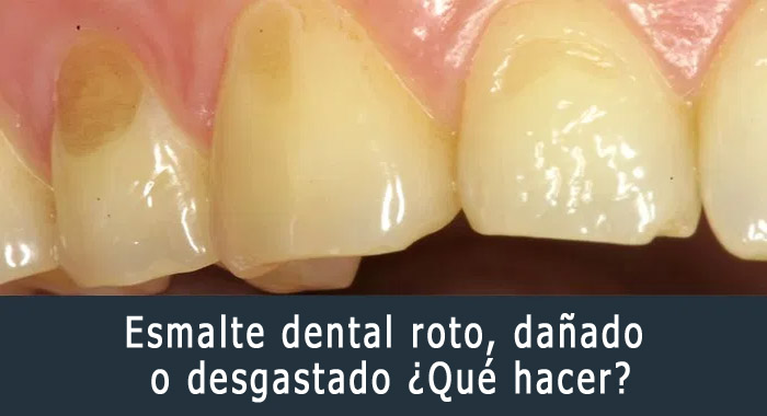 esmalte-dental