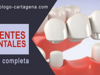Puente dental Cartagena