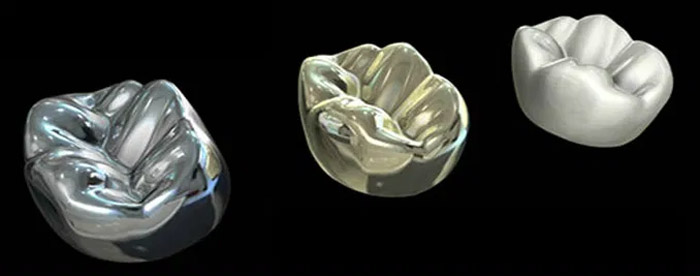 Corona dental en metal