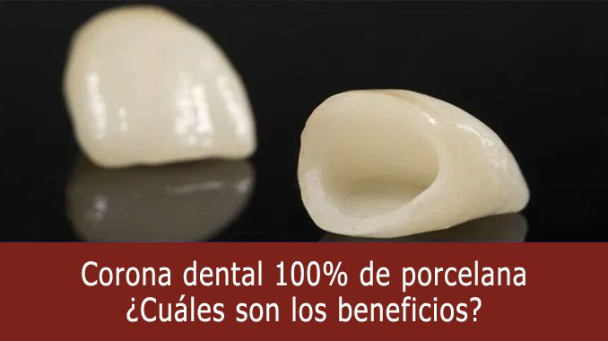 Corona dental porcelana