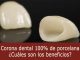 Corona dental porcelana