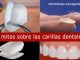 Mitos carillas dentales