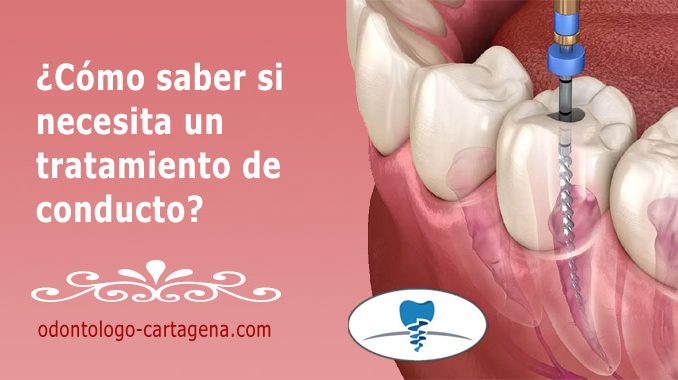 necesita-tratamiento-conducto ¿Cómo saber si necesita un tratamiento de conducto?