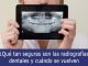 Qué tan seguras son las radiografías dentales