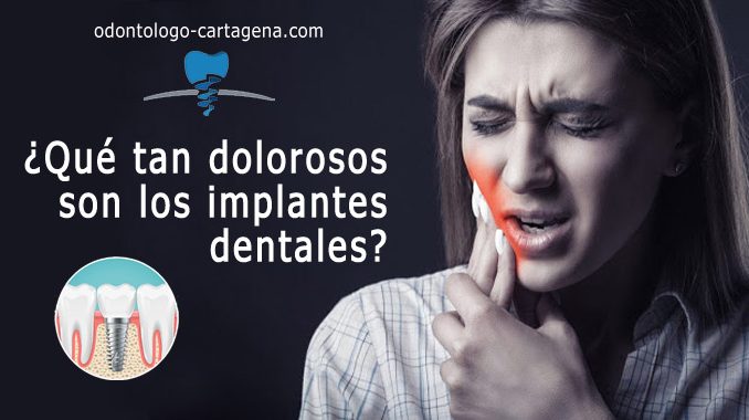 ¿Qué tan dolorosos son los implantes dentales?