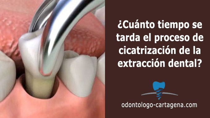 cicatrizacion-extraccion proceso de cicatrización de la extracción dental