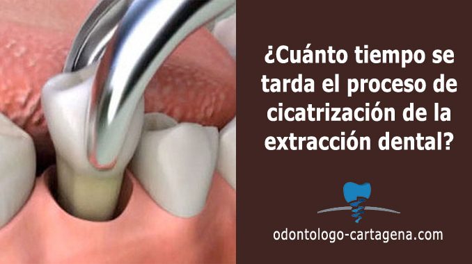 proceso de cicatrización de la extracción dental