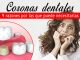 Coronas dentales: 9 razones