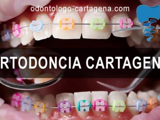 Ortodoncia en Cartagena de Indias