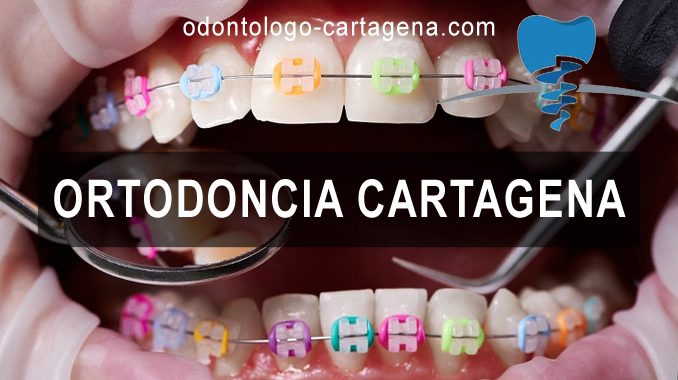 Ortodoncia en Cartagena de Indias