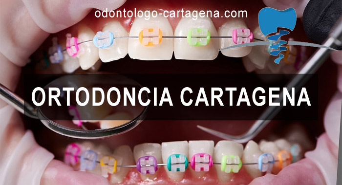 ortodoncia-cartagena